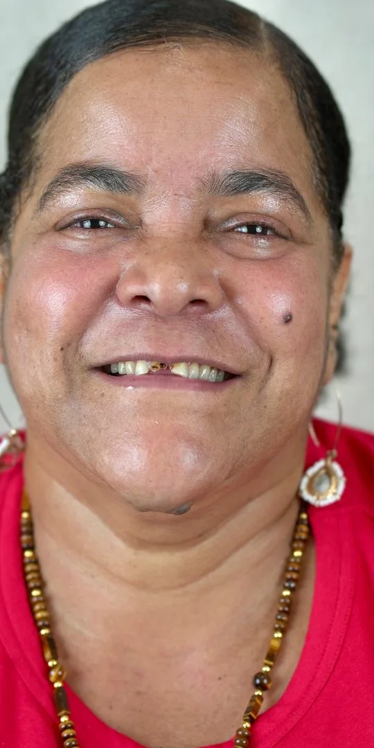 Full-face transformation before a smile makeover